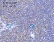 P62/SQSTM1?Recombinant antibody