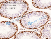 PCNA Recombinant antibody