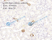SMA-α Recombinant antibody