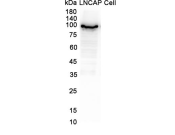 beta-Catenin Recombinant antibody