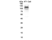 E-Cadherin Recombinant antibody