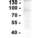 CD45 Recombinant antibody