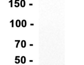 Claudin 1 Recombinant antibody