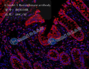Claudin 1 Recombinant antibody