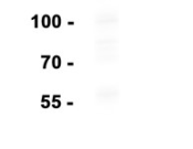 CD11B Recombinant antibody
