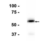 CD4 Recombinant antibody