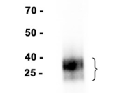 CD8 Recombinant antibody