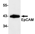 EPCAM/CD326 Recombinant antibody