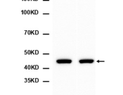 Foxp3 Recombinant antibody