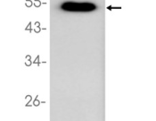 P53 Recombinant antibody