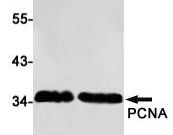 PCNA Recombinant antibody