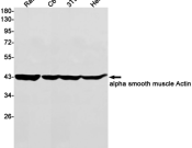 SMA-α Recombinant antibody