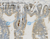 SOX9 Recombinant antibody