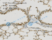 YAP1 Recombinant antibody