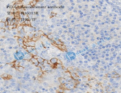 PD-L1/CD274 Monoclonal antibody