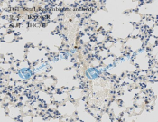 TGF Beta1 Recombinant antibody