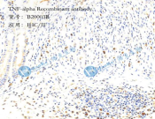 TNF-alpha Recombinant antibody