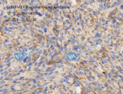 GSDMD Recombinant antibody