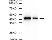 TGF Beta1 Recombinant antibody