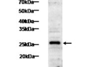 TNF-alpha Recombinant antibody
