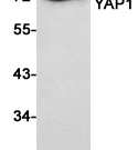 YAP1 Recombinant antibody