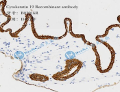 Cytokeratin 19 Recombinant antibody