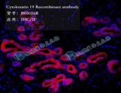 Cytokeratin 19 Recombinant antibody