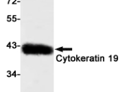 Cytokeratin 19 Recombinant antibody