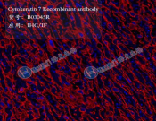 Cytokeratin 7 Recombinant antibody