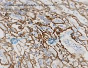 Cytokeratin 7 Recombinant antibody