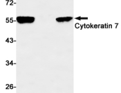 Cytokeratin 7 Recombinant antibody