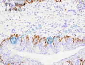 PCNA Recombinant antibody