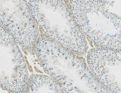 VDAC1/Porin Recombinant antibody