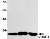 VDAC1/Porin Recombinant antibody