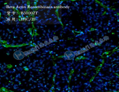 Beta Actin Recombinant antibody