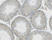 COXIV Recombinant antibody