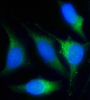 ABI2?Recombinant antibody