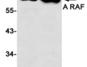 A RAF?Recombinant antibody