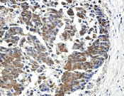 4E BP1?Recombinant antibody