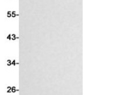 4E BP1?Recombinant antibody