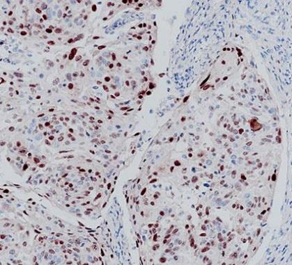 p21 Recombinant antibody