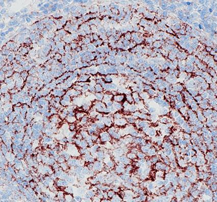 CD35 Recombinant antibody