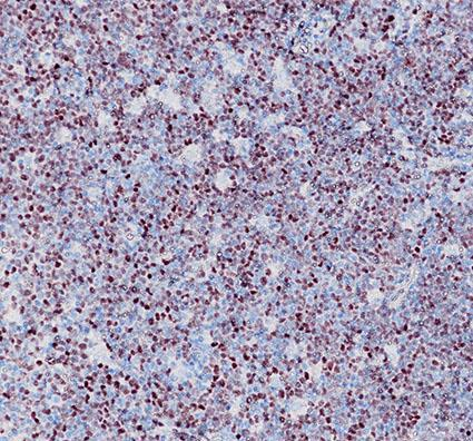 SOX11 Recombinant antibody