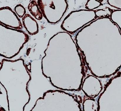 TPO?Recombinant antibody
