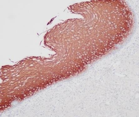 Cytokeratin 1 Recombinant antibody