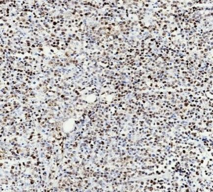 Cyclin D1 Recombinant antibody