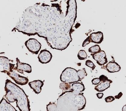 hCG Recombinant antibody