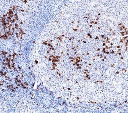 CD38 Recombinant antibody