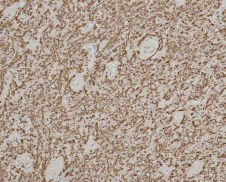 Myelin Basic Protein Recombinant antibody