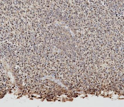 S100 Recombinant antibody